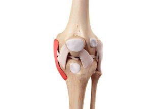 Medial Collateral Ligament | Any Stage Physiotherapy and Sports Medicine